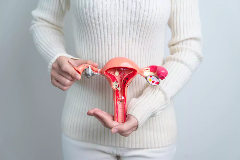 Endometriosis
